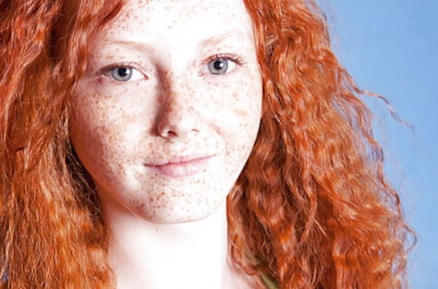 freckles, ginger, orangehair