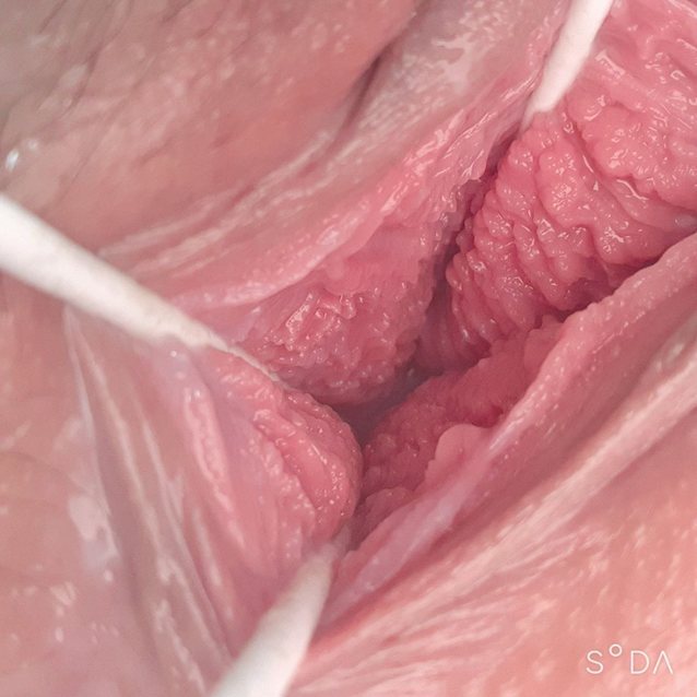 endoscope, vaginal, japanese