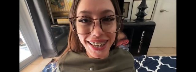 family therapy asian braces