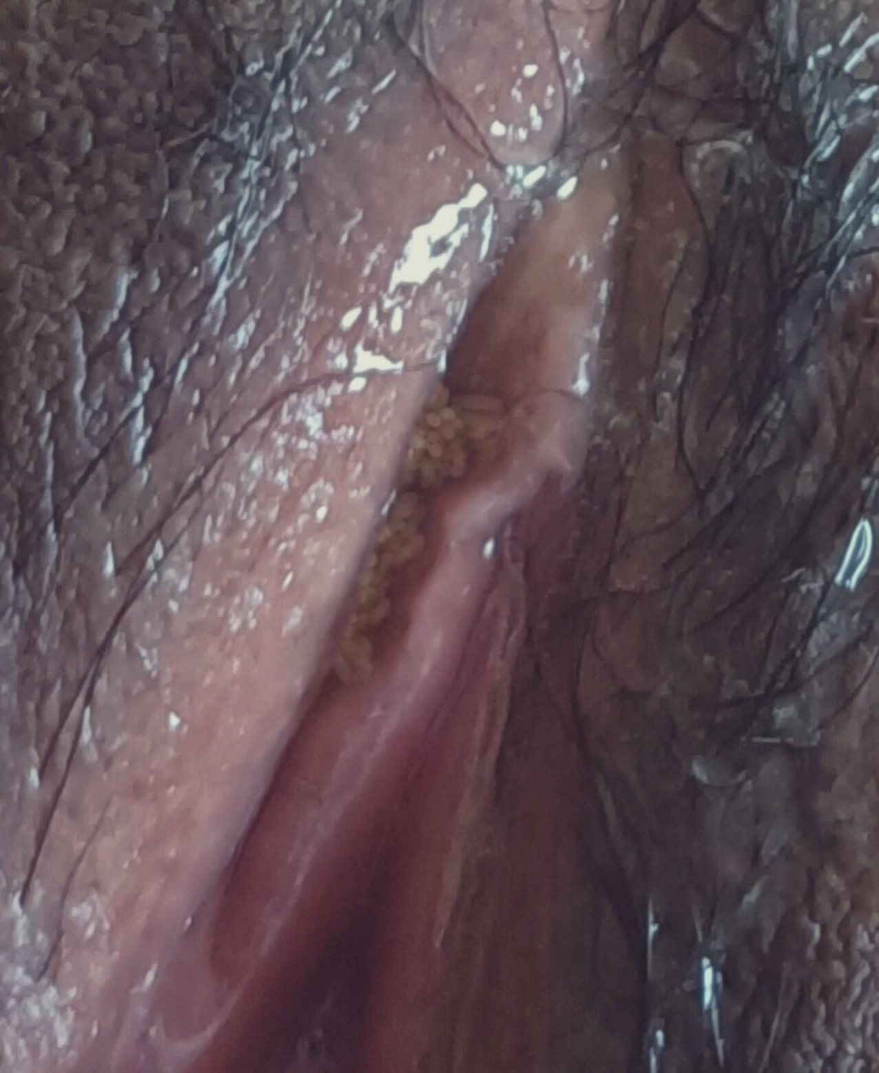 pussy maggots asian picture