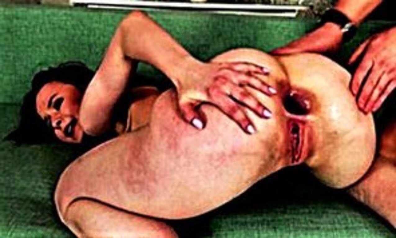 anal gape gapes