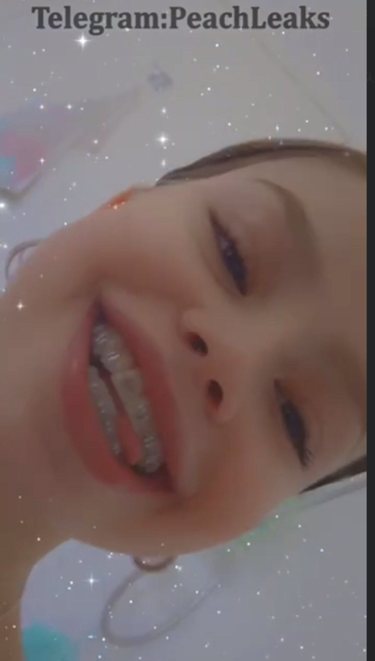 braces cute teen