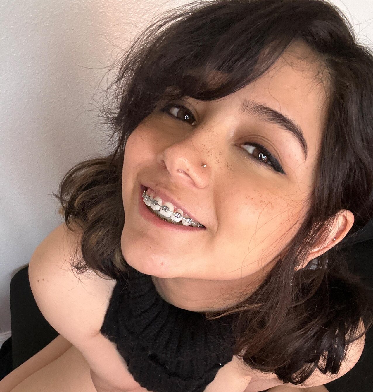 teen braces cum