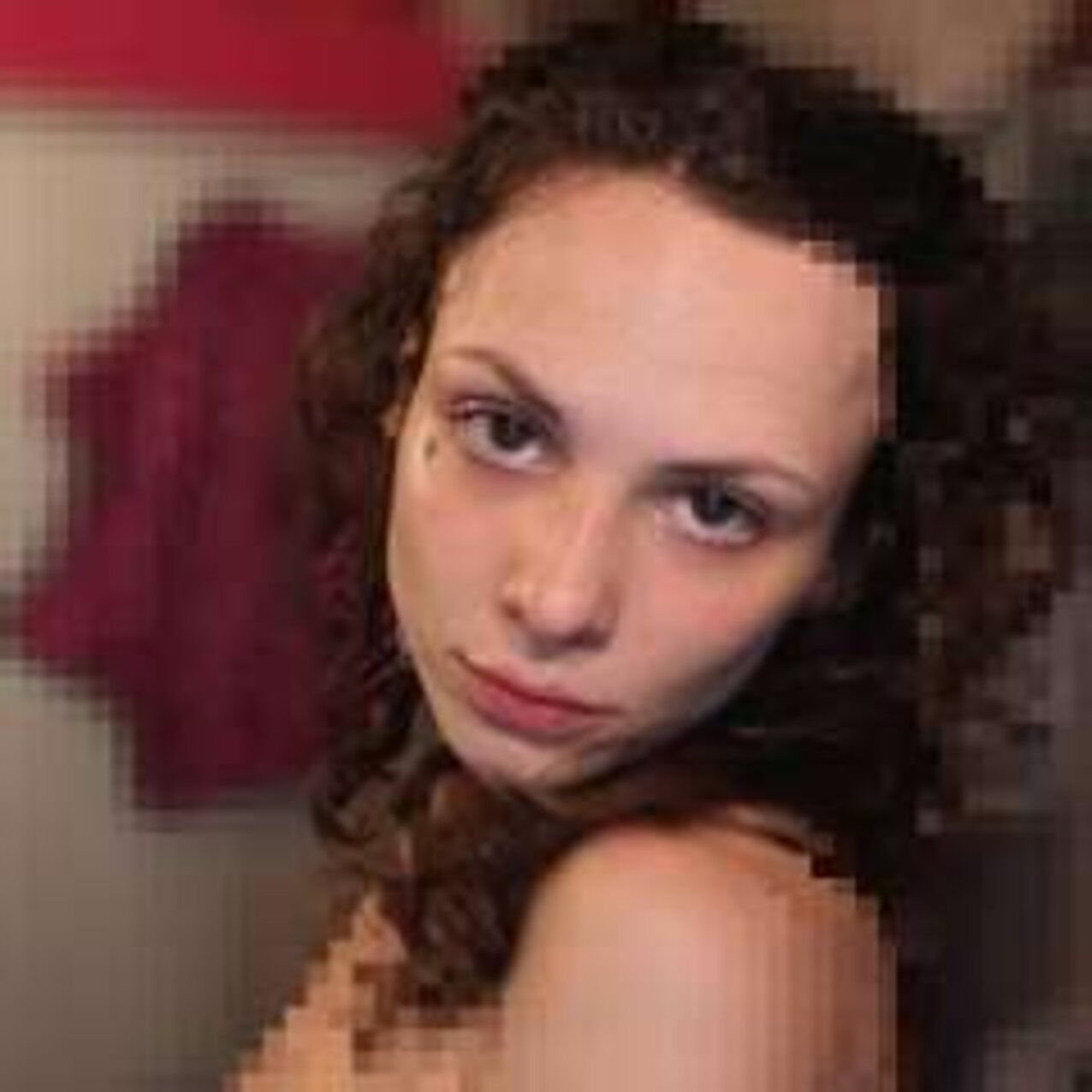 brunette birthmark white