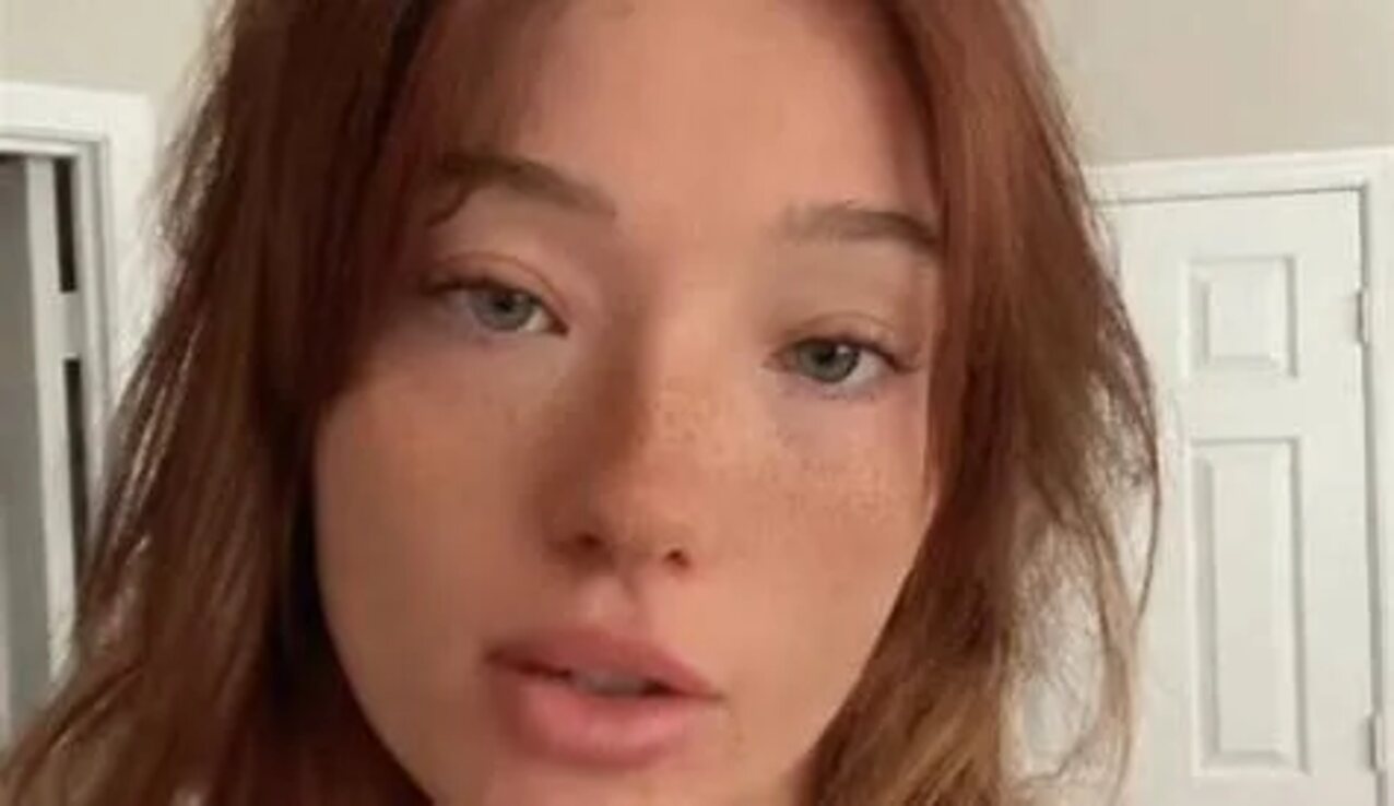 face freckles head