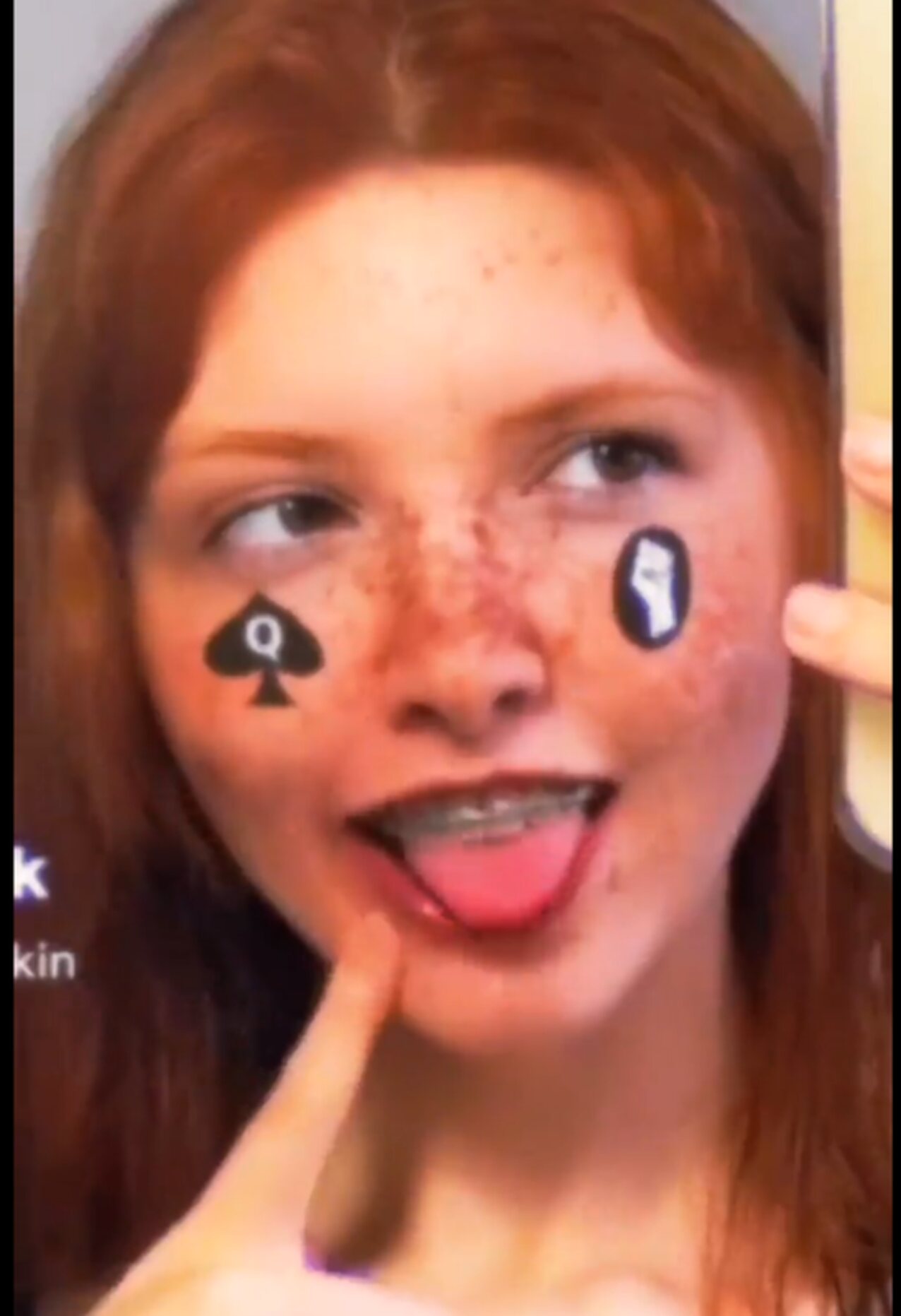 ginger redhead freckles