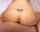anal