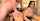 anal