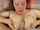 facial