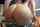 anal