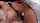 anal