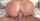 anal