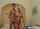 teen