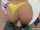 anal