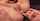 anal