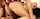 anal