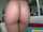 anal