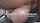 anal