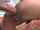 anal
