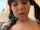facial teen