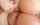anal