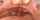 anal