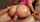 anal