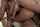 kink