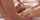 anal