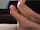 kink feet soles