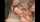 facial