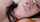 anal