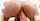 anal