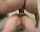 anal