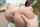 anal