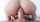 anal