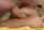 anal