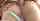 anal