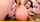 anal