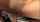 anal
