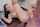 facial teen