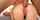 anal