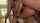kink