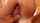 anal
