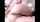 anal