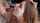 facial teen