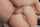 anal
