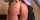 kink
