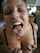 facial