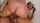 facial teen